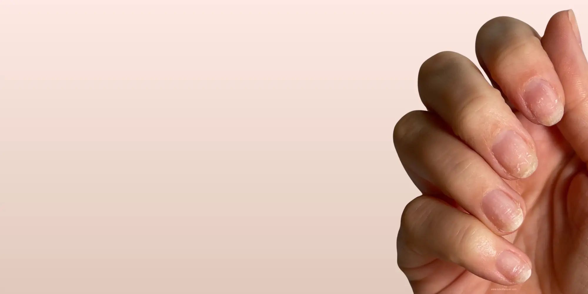 How to Stop Your Nails From Breaking: Simple Tips for Stronger Nails